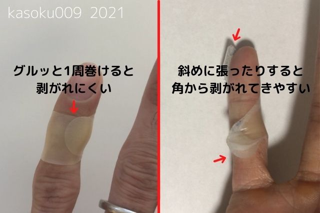 アトピーの僕がキズパワーパッドの効果を検証してみた 写真付き Kasoku009の雑記ブログ